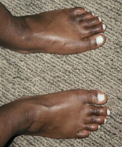 5 STARS UNITED Toe Spacers for Men and Women – 4 Gel Toe Separators for Curled and Overlapping Toes, Bunions, Hammer Toe Straightener, Big and Second Toe Spreader Big 4 Pack 42 81JMlHB6ReL