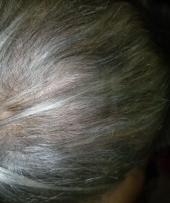 Ultrax Labs Hair Growth Shampoo for Thinning Hair and Hair Loss, Hair Thickening Shampoo, Hair Growth for Women and Men - Hair Surge 8 oz 8 Fl Oz (Pack of 1) - Shampoo 42 81JVr V4zCL