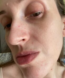 Mario Badescu Drying Lotion, 1 Fl oz 01 Drying Lotion Glass Bottle, 1 Fl oz 37 81Jej07bN1L