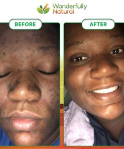 Organic African Black Soap - For Acne & Dark Spots | Natural Vegan and Cruelty Free – Satisfaction Guarantee 1lb bar | 90 day Supply 1 Pound (Pack of 1) 32 81LKPI3iDwL 1