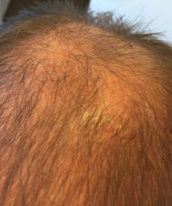 Hairgenics Pronexa Clinical Strength Hair Growth & Regrowth Therapy Hair Loss Shampoo With Biotin, Collagen, and DHT Blockers for Thinning Hair, 8 fl. oz. 50 81O1tn0Q1sL 3