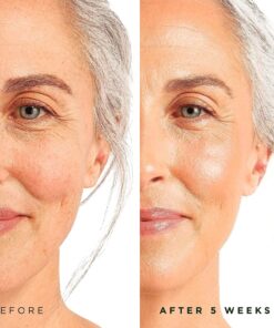 Tree of Life Retinol Serum for Face w/Hydrating Hyaluronic Acid for Wrinkle Soothing, Fine Lines & Dark Spots - 2 Fl Oz - Renew & Reset Nighttime Serums - Dermatologist Tested Facial Skin Care 2 Fl Oz (Pack of 1) 28 81P Cjq5Y6L