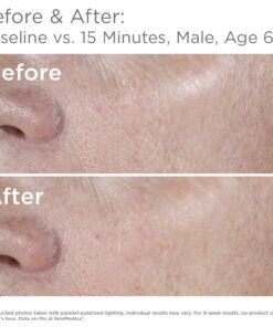 SkinMedica HA5 Rejuvenating Hydrator Hyaluronic Acid Serum for Face with Five Types of Hyaluronic Acid that Smooth Fine Lines and Wrinkles, For All Skin Types, 2 Oz 2 Ounce (Pack of 1) 20 81Psbw7B0AL