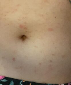 Truremedy Naturals Remedy Tea Tree Oil Body Wash - Body Wash That Helps Body Odor, Ringworm, & Skin Irritations - Tea Tree Soap Body Wash (1 pk, 12 oz) 12 Fl Oz (Pack of 1) 32 81Rk0ldjGZL