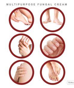 Anti fungal oil system for treatment of fungal infections on nail, toes, feet, fingers, skin | treats mold and yeast infections with fast relief | contains 7 natural oils including tea tree oil 1 5 81T6 P0ghAL