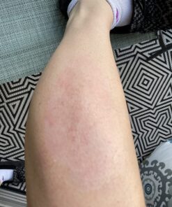 Band-Aid Brand Hydro Seal Adhesive Hydrocolloid Gel Bandages for Wound Care & Blister Relief, All Purpose Waterproof & Shower Proof Blister Pad, Sterile & Long-Lasting, Extra Large, 3 ct 3 Count (Pack of 1) 39 81UALuEejaL