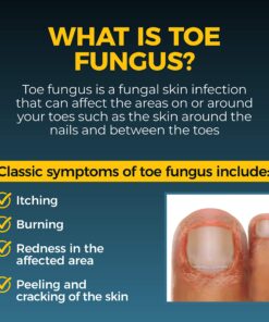 Fungi Nail Anti-Fungal Ointment, Kills Fungus That Can Lead to Nail & Athlete’s Foot with Tolnaftate & Clinically Proven to Cure Infections, Natural Color, 0.7 Fl Oz 26 81VFserqNuL