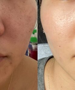 Paulas Choice--SKIN PERFECTING 2% BHA Liquid Salicylic Acid Exfoliant--Facial Exfoliant for Blackheads, Enlarged Pores, Wrinkles & Fine Lines, 4 oz Bottle 4.00 Fl Oz (Pack of 1) 31 81VRub3VmYL