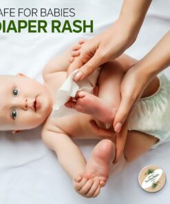 TEA TREE OIL BALM -100% All Natural | Great Cream for Soothing Irritations like Eczema, Psoriasis, Rashes, Insect Bites, Folliculitis, Acne, Itches, Dry Chapped Heels, Cuticles, Saddle Sores and more! 34 81Vz1x0Y5tL