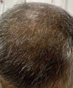 PURA D'OR Deep Moisturizing Biotin Conditioner (16oz) Thickens, Softens, & Moisturizes Dry, Frizzy, Damaged Hair w/Argan Oil, Pumpkin, Rosemary, Honeysuckle, Vitamin E, Men Women (Packaging may vary) 16 Fl Oz (Pack of 1) 38 81XRGNFCJ4L