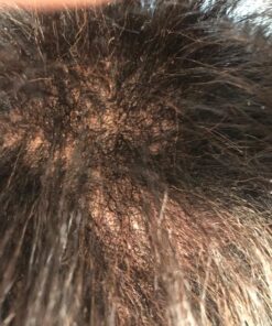 SheaMoisture Jamaican Black Castor Oil Treatment Masque Jamaican Black Castor Oil For Dry Hair Paraben Free Hair Mask 11.5oz 52 81ZlgW8C86L