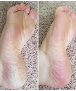 Microplane Colossal Foot File Scraper - The Original Stainless Steel Foot Rasp, Dead Skin/Callus Remover for Feet, Gentle Foot Scrubber, Pedicure Tools for Salon-Quality Foot Care, Black 74 81Zozk2yQZL