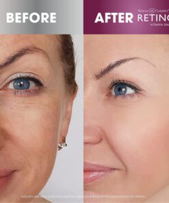 Retinol Anti-Wrinkle Facial Serum – Vitamin A Concentrate Improves Skin’s Elasticity & Tone and Minimizes Appearance of Fine Lines & Wrinkles – Look Younger With The Age-Defying Power Of Retinol 14 81c uFHiFuL