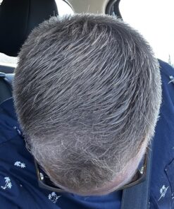 Nutrafol Men's Hair Growth Supplements, Clinically Tested for Visibly Thicker Hair and Scalp Coverage, Dermatologist Recommended - 1 Month Supply 58 81dNvzgBrZL