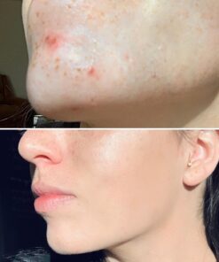 Hada Labo Tokyo Skin Plumping Gel Cream with Super Hyaluronic Acid & Collagen, 1.76 Fl Oz, Non-Comedogenic, Unscented 43 81dP3wrWlzL