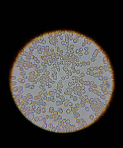 AmScope M150C-I 40X-1000X All-Metal Optical Glass Lenses Cordless LED Student Biological Compound Microscope 54 81eMOJ8L