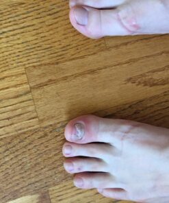 PURELY NORTHWEST-Natural Tea Tree & Peppermint Body Wash for Men & Women-Refreshing Daily Soap for Body Odor & Hygiene, Acne-Effectively Soothes Jock Itch, Chafing & Athletes Foot-Discolored Nails-9oz 9 Fl Oz (Pack of 1) 44 81ed d9YaL