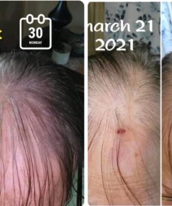 Sports Research Vegan Biotin 10,000mcg with Coconut Oil - Max Strength Biotin Vitamin B7 for Skin and Keratin Support - Non-GMO & Gluten Free, 120 Softgels (4 Month Supply) 120 Count (Pack of 1) 53 81gMdhCnG L