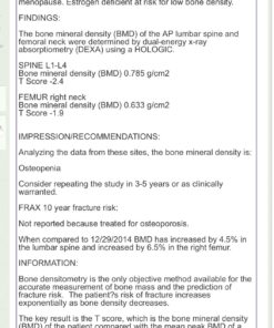 New Chapter Calcium Supplement – Bone Strength Organic Plant Calcium with Vitamin K2 + D3 + Magnesium, Vegetarian, Gluten Free - 120 count (40 day supply) 16 81gaJ57D5fL