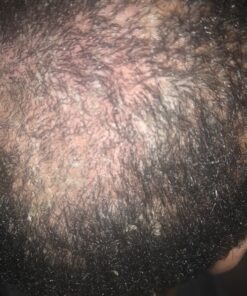 Organic Aloe Vera Gel - 100% Pure for Skin, Sunburn Relief & Face Moisturizer - Extracted from Aloe Vera Plant with Manuka Honey, Orchid & Apple Stem Cells - Everyday Use - 8 Fl Oz 8 Fl Oz (Pack of 1) 30 81gr3SihMtL 1