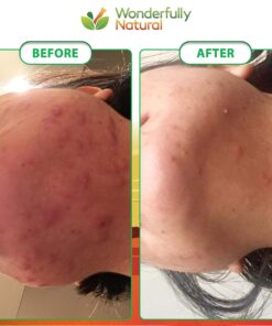 Organic African Black Soap - For Acne & Dark Spots | Natural Vegan and Cruelty Free – Satisfaction Guarantee 1lb bar | 90 day Supply 1 Pound (Pack of 1) 34 81hxV6R 8wL 1