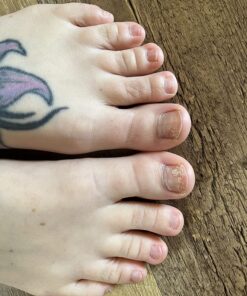 Toenail Fungus Treatment Extra Strength with 25% Undecylenic Acid - Fungal Nail Treatment for Toe Nail & Fingernails - Antifungal Nail Repair Solution for Discoloured & Ingrown Nails – Made in USA 0.5 Fl Oz (Pack of 1) 63 81i1stujceL 3