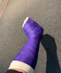 TKWC INC Water Proof Leg Cast Cover for Shower - #5738 - Watertight Foot Protector 33 81j5JmL0edL