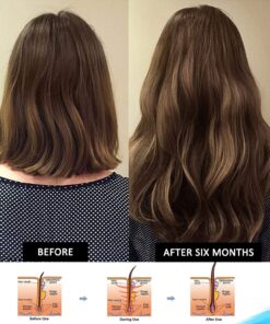 Hairgenics Pronexa Clinical Strength Hair Growth & Regrowth Therapy Hair Loss Shampoo With Biotin, Collagen, and DHT Blockers for Thinning Hair, 8 fl. oz. 35 81jv0rjG9qL