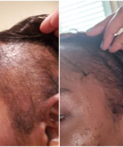 DrFormulas HairOmega 3-in-1 Hair Growth Vitamins with DHT Blocker, Biotin for Women & Men | Hair Skin and Nails Supplement for Hair Loss, 120 Pills 120 Count (Pack of 1) 33 81lFLDXZ FL