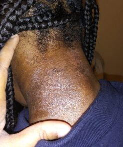 Burt's Bees Baby Diaper Balm, Multipurpose Healing Ointment Softens & Calms Dry Skin, Eczema Safe, with Shea Butter, Plant Based Formula, Pediatrician Tested, 7.5 Oz 7.5 Ounce (Pack of 1) 62 81n6IgOW3cL 1