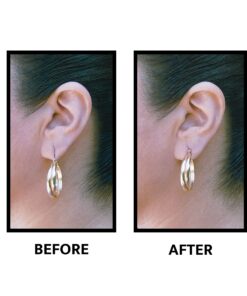 Lobe Wonder - The ORIGINAL Ear Lobe Support Patch for Pierced Ears - Eliminates the Look of Torn or Stretched Piercings - Protects Healthy Ear Lobes from Tearing - 60 Patches - Clear & Latex-Free 31 81p8jZmHAL