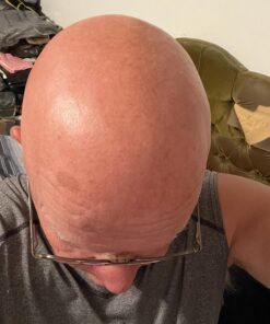 Head Shaver for Bald Men,5 in 1 Bald Head Shavers for Men Cordless,Waterproof Wet/Dry 5 Head Mens Electric Razor for Head Face Shaving, USB Mans Grooming Kit Rechargeable,Rotary Shaver Gift for Men 41 81qYlLmGpIL