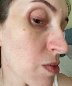 Mario Badescu Drying Lotion, 1 Fl oz 01 Drying Lotion Glass Bottle, 1 Fl oz 38 81swC0kbvHL