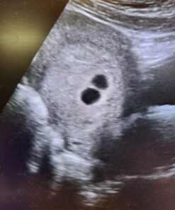 (2 Month Supply) Cassava Root - Fertility Supplement for Twins - Vitamin for a Natural Pregnancy 26 81v01iRXNpL