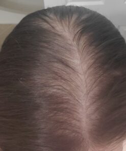 PURA D'OR Professional Grade Biotin Anti-Hair Thinning Shampoo & Conditioner, CLINICALLY TESTED Proven Results, 2X Concentrated DHT Blocker Thickening Products For Women & Men, Sulfate Free, 16oz x 2 33 81vD kPFqfL 2