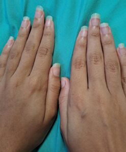 Nutra Nail 5 to 7 Day Growth Treatment - Fast Keratin Nail Hardener & Nail Strengthener for Thin Nails, Brittle & Damaged (0.47 Fl Oz) 0.50 Fl Oz (Pack of 1) 37 81vKF4J9IoL 2