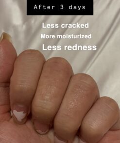 Eucerin Eczema Relief Cream, Full Body Lotion for Eczema-Prone Skin, Moisturizing Eczema Cream, Body Moisturizer, 8 oz. Tube 47 81yMhI8IpsL