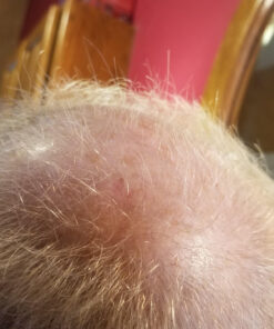 Ultrax Labs Hair Growth Shampoo for Thinning Hair and Hair Loss, Hair Thickening Shampoo, Hair Growth for Women and Men - Hair Surge 8 oz 8 Fl Oz (Pack of 1) - Shampoo 34 81yW OSea9L