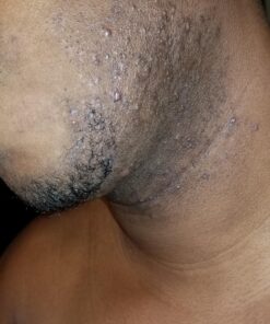 Tend Skin Razor Bump Solution, 4 ounce, Post Shaving & Waxing, for women & men 45 917OHVSP9mL