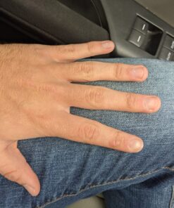 Compound W Nitrofreeze | Wart Removal | 1 Pen & 5 Replaceable Tips 68 91BHvtVx8xL