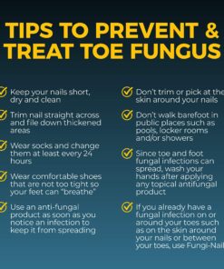 Fungi Nail Anti-Fungal Ointment, Kills Fungus That Can Lead to Nail & Athlete’s Foot with Tolnaftate & Clinically Proven to Cure Infections, Natural Color, 0.7 Fl Oz 27 91BWmtNmxmL