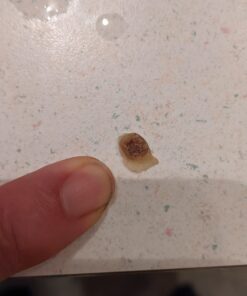 Compound W Nitrofreeze | Wart Removal | 1 Pen & 5 Replaceable Tips 63 91EGZt3E L