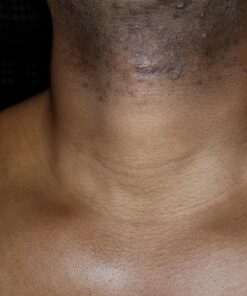 Tend Skin Razor Bump Solution, 4 ounce, Post Shaving & Waxing, for women & men 46 91K046DkkFL