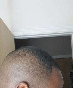 6 Months Kirkland Minoxidil 5% Extra Strength Hair Loss Regrowth Treatment Men, 12 Fl Oz (Pack of 6) 49 91KKqEu5UrL