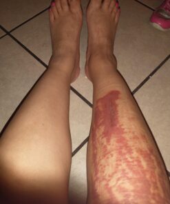 Medline Remedy Olivamine Clear-aid Skin Protectant, 2.5 Ounce 9 91LNOjDR4aL