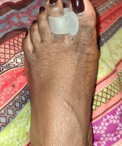 5 STARS UNITED Toe Spacers for Men and Women – 4 Gel Toe Separators for Curled and Overlapping Toes, Bunions, Hammer Toe Straightener, Big and Second Toe Spreader Big 4 Pack 51 91ONcmGggL