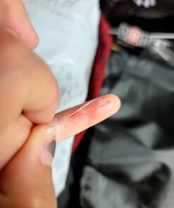 Structured Colloidal Silver Gel for Burns and Wounds - Cooling Silver Extra Strength 35ppm Silver Gel 27 91OuvlhgHjL