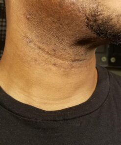 Tend Skin Razor Bump Solution, 4 ounce, Post Shaving & Waxing, for women & men 47 91TOUNm8KlL