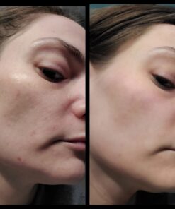 DearKlairs Freshly Juiced Vitamin Drop, 5% Hypoallergenic pure vitamin C serum, 1.18oz | ascorbic acid vitamin c serum, antioxidant serum for face, korean skincare 49 91XiICsxE4L