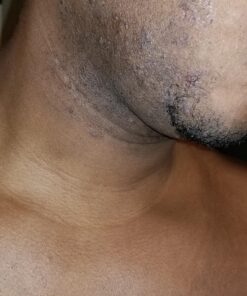 Tend Skin Razor Bump Solution, 4 ounce, Post Shaving & Waxing, for women & men 48 91bdvBIkS6L